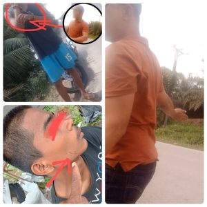 Gawat….!!! Oknum PTPN IV PalmCo Regional III Distrik Barat Diduga Melakukan Penganiayaan Terhadap Anak Dibawah Umur.