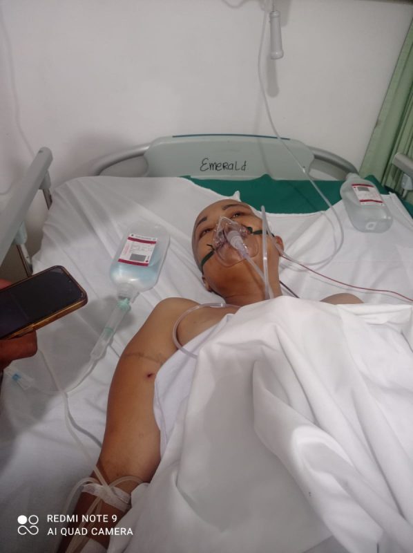 Di Pangururan Seorang Wanita Diduga Dianiaya Hingga Batok Kepala Retak Dan Pendarahan Pada Otak. 