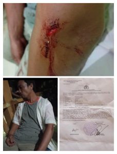Kepastian Hukum Belum Jelas, Korban Siap Membalaskan Kepada Pelaku Ini Pertanyaan Korban Menyampaikan Kepada Awak Media