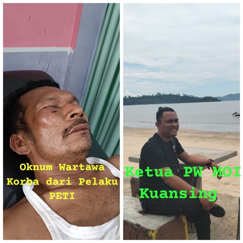 Wartawan Korban Kekerasan Brutal dari Pelaku PETI, Sugianto Ketua PW MOI Desak Polres Kuansing Tangkap Pelakunya.